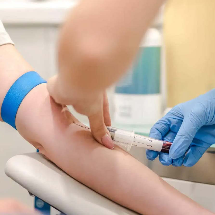 gold coast doctor for blood tests